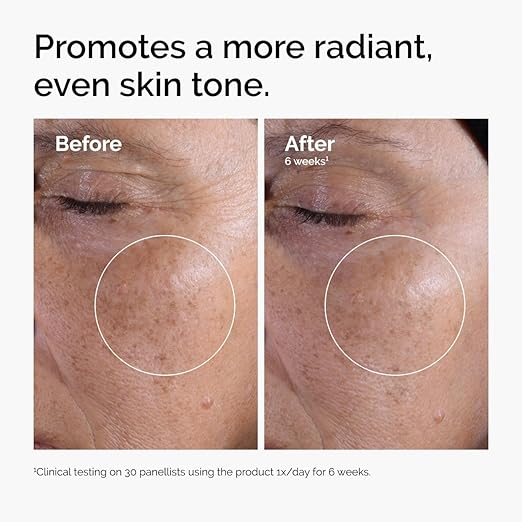 The Ordinary Glycolic Acid 7% Exfoliating Toner | Brightening Daily Face Toner.